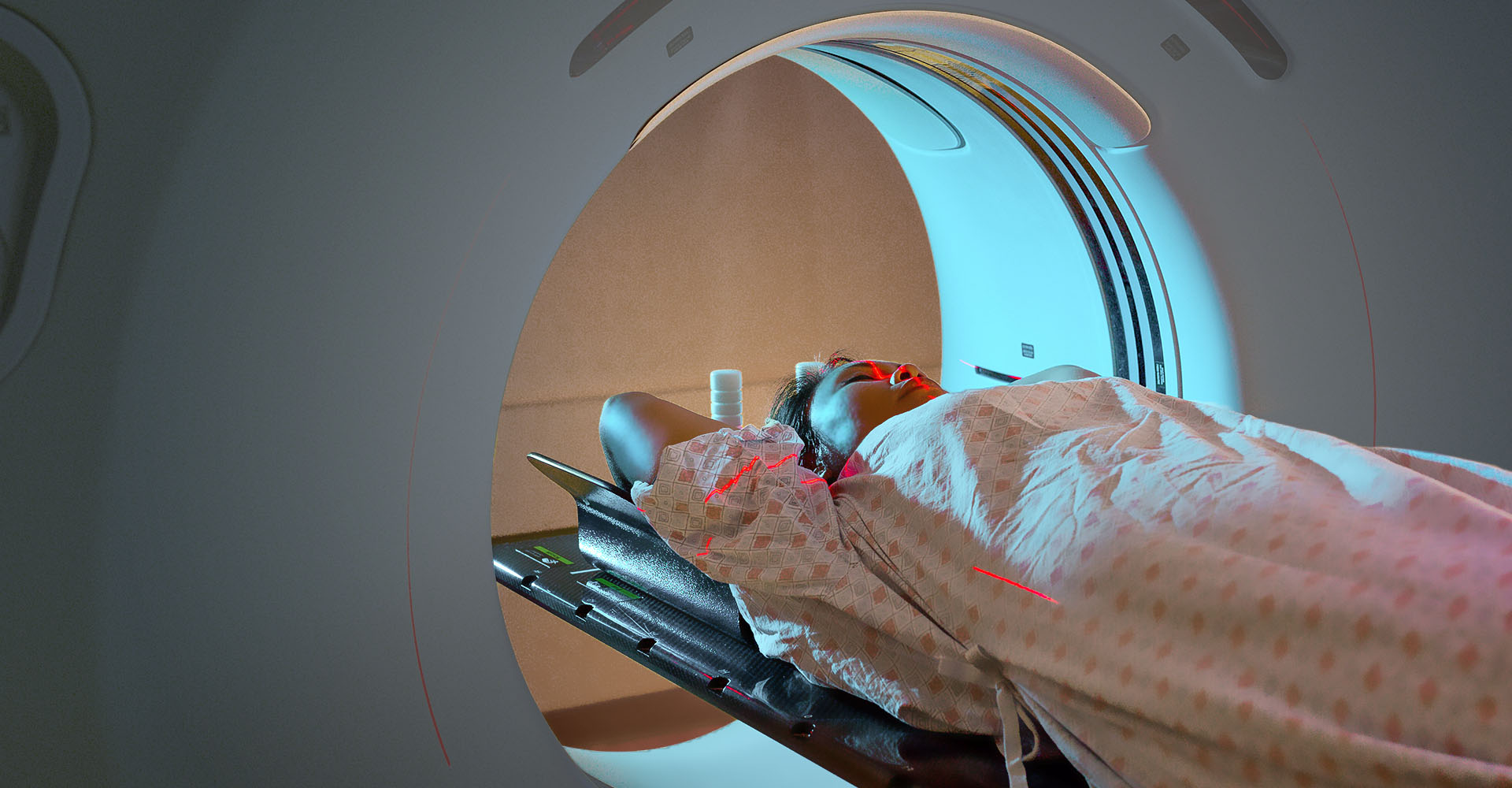 Women being treated with Radiotherapy