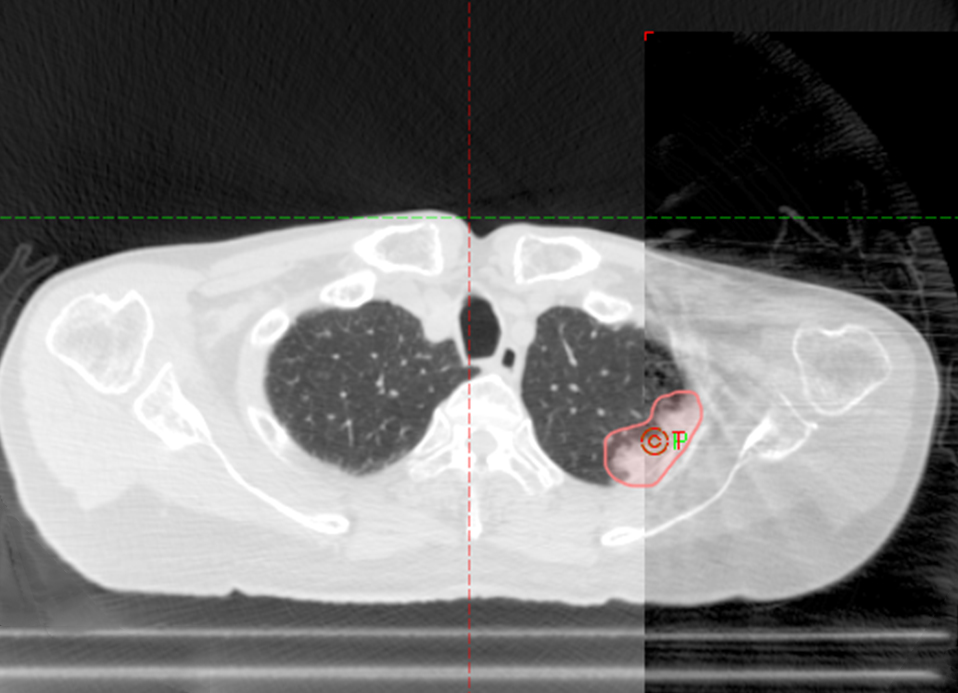Cone Beam Computed Tomography Image